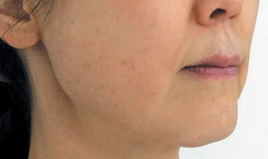 Клиника красоты и здоровья Софитэль Oligio