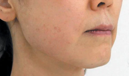 Клиника красоты и здоровья Софитэль Oligio