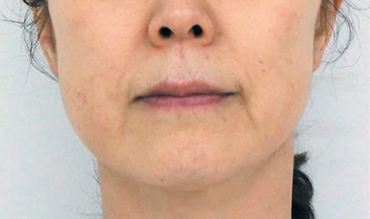 Клиника красоты и здоровья Софитэль Oligio