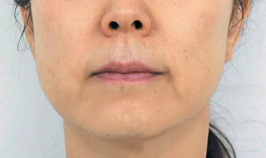 Клиника красоты и здоровья Софитэль Oligio