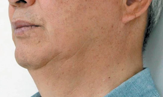 Клиника красоты и здоровья Софитэль Oligio