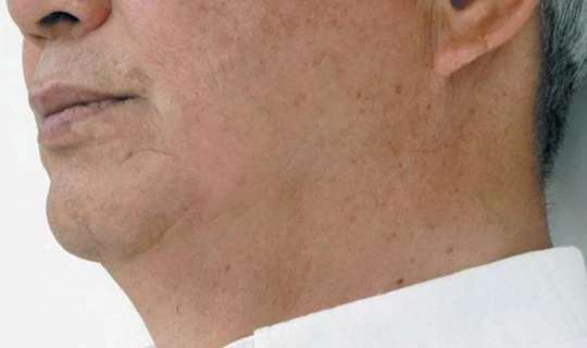 Клиника красоты и здоровья Софитэль Oligio