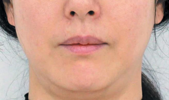 Клиника красоты и здоровья Софитэль Oligio