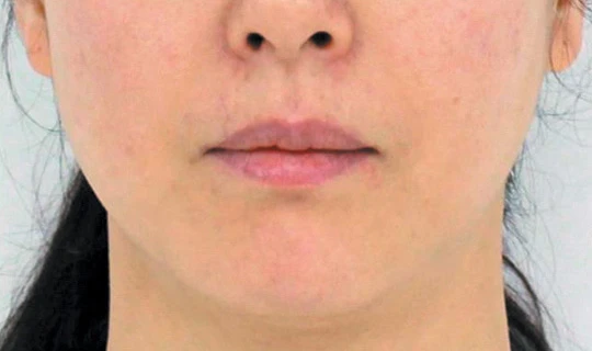 Клиника красоты и здоровья Софитэль Oligio